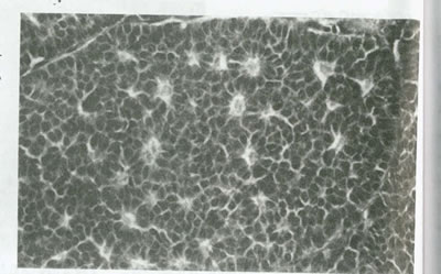 بيماريهاي تخمدان و لوله هاي رحمي چیست؟(1)